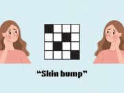 Petunjuk teka-teki silang NYT Mini ‘Skin bump’ jawaban dan petunjuk 28 Agustus